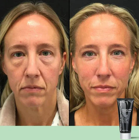 Temporary Face Tightener (🎁Buy More Save More)