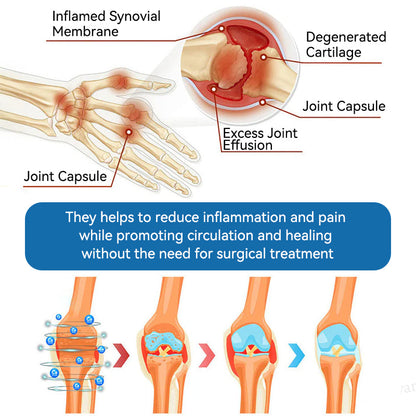 🇬🇧𝐟𝐥𝐲𝐬𝐦𝐮𝐬® 𝐁𝐏𝐂-𝟏𝟓𝟕 𝐉𝐨𝐢𝐧𝐭 𝐇𝐞𝐚𝐥𝐢𝐧𝐠 𝐂𝐫𝐞𝐚𝐦🦴Treats Arthritis, Neuropathy, Rheumatism, Sports Injuries & More🇬🇧🏆