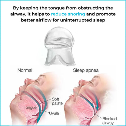[Official Store]JEREMYTIS™ - Anti Snoring Device