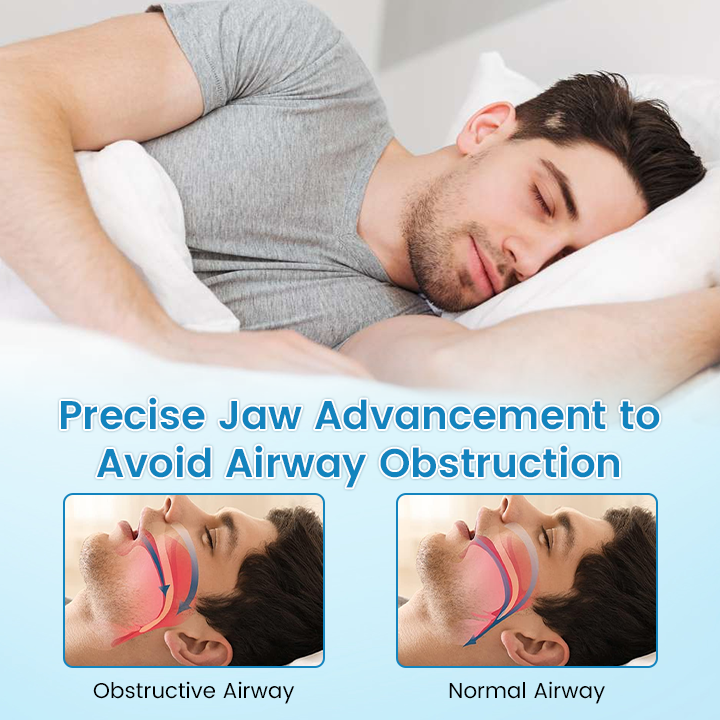 ✨[Official Store] JEREMYTIS™ Anti-Snoring & Anti-Grinding Teeth Protector