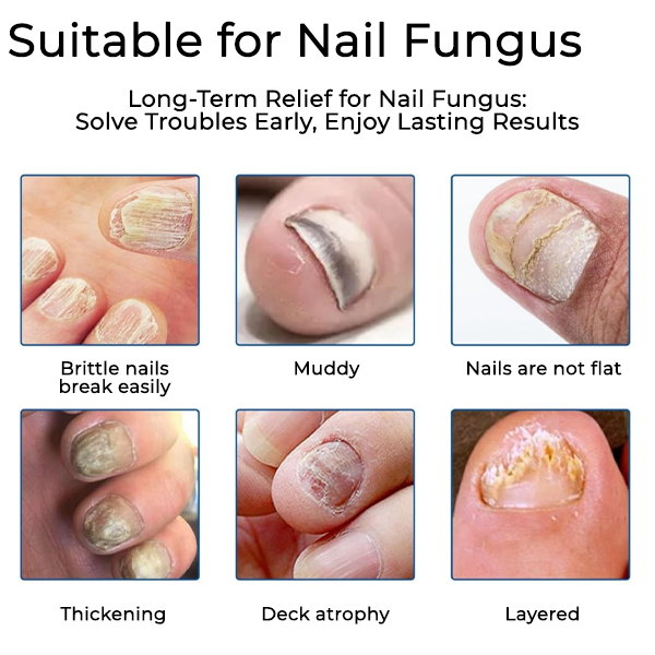 [Official Store] Nail Fungus Care Patches