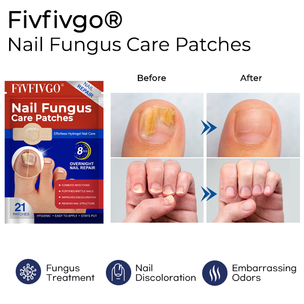 [Official Store] Nail Fungus Care Patches