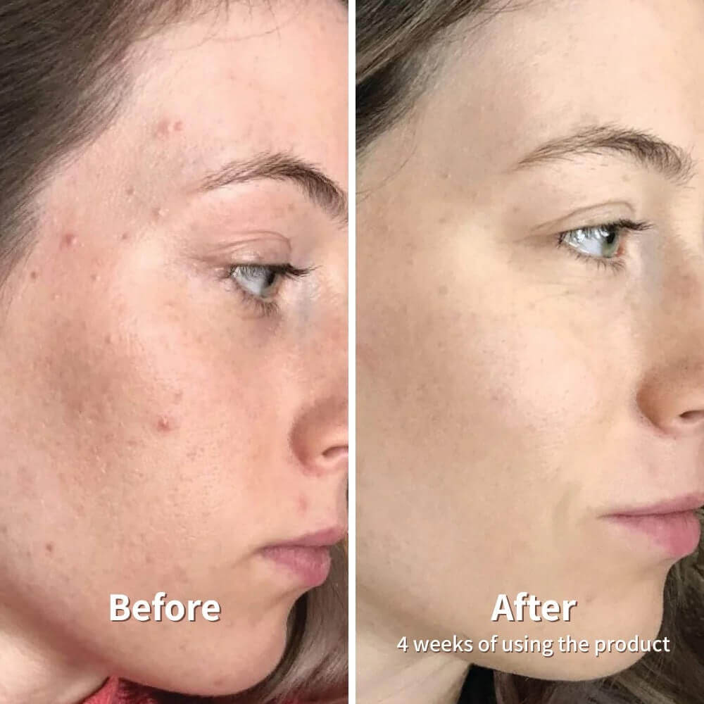 Dr. Melaxin PEEL SHOT™️